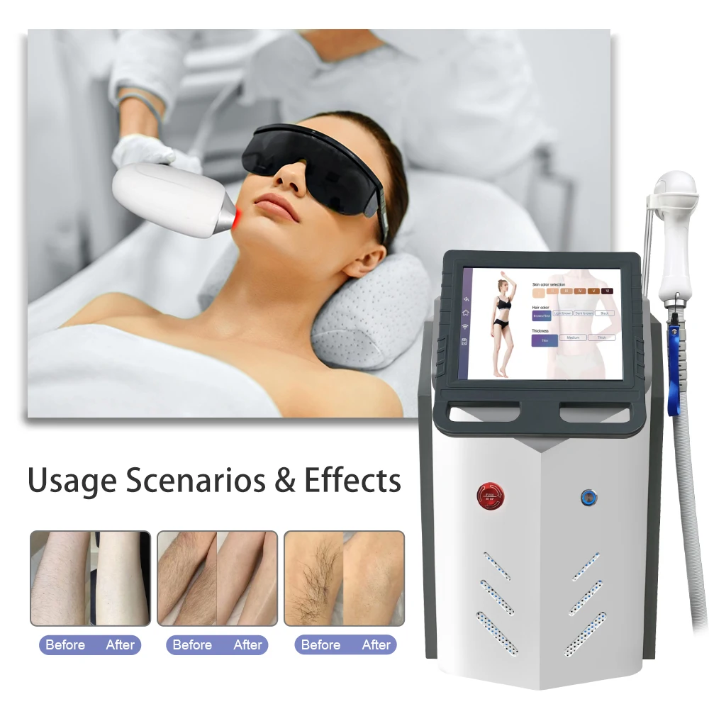 2024 newest high power diode laser 808 nm ice plat smart diode laser hair removal bars beauty machine