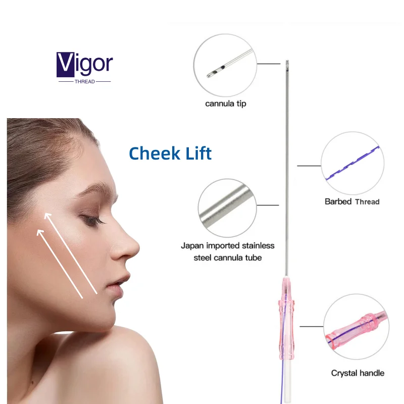 Vigor korean pdo barbed suture for the pdo thread lift double needle facial tension tornado pdo thread lift double needle