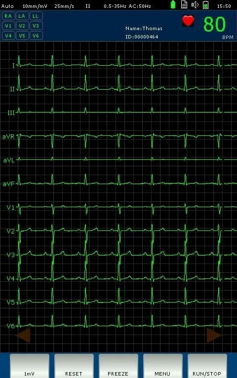 Veterinary Instrument DAWEI Best Sales High Sensitive Vet Portable 3 Channel ECG EKG Electrocardiogram MachineOther Veterinary