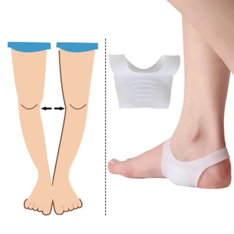 support pad O/X Type Leg Medial Lateral Gel Heel Insoles flat foot Orthopedic Corrective Shoe Inserts Help Foot Alignment Knee