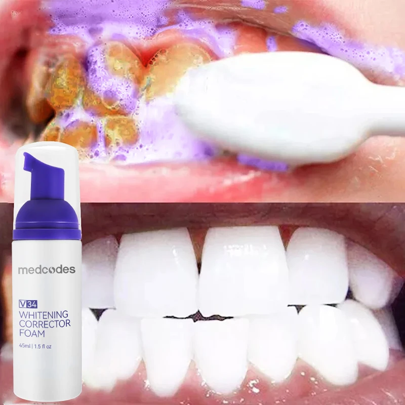 Customized Modern Best Teeth Whitening Toothpaste Color Corrector Purple Dentifrice Toothpaste Mousse V34 Toothpaste