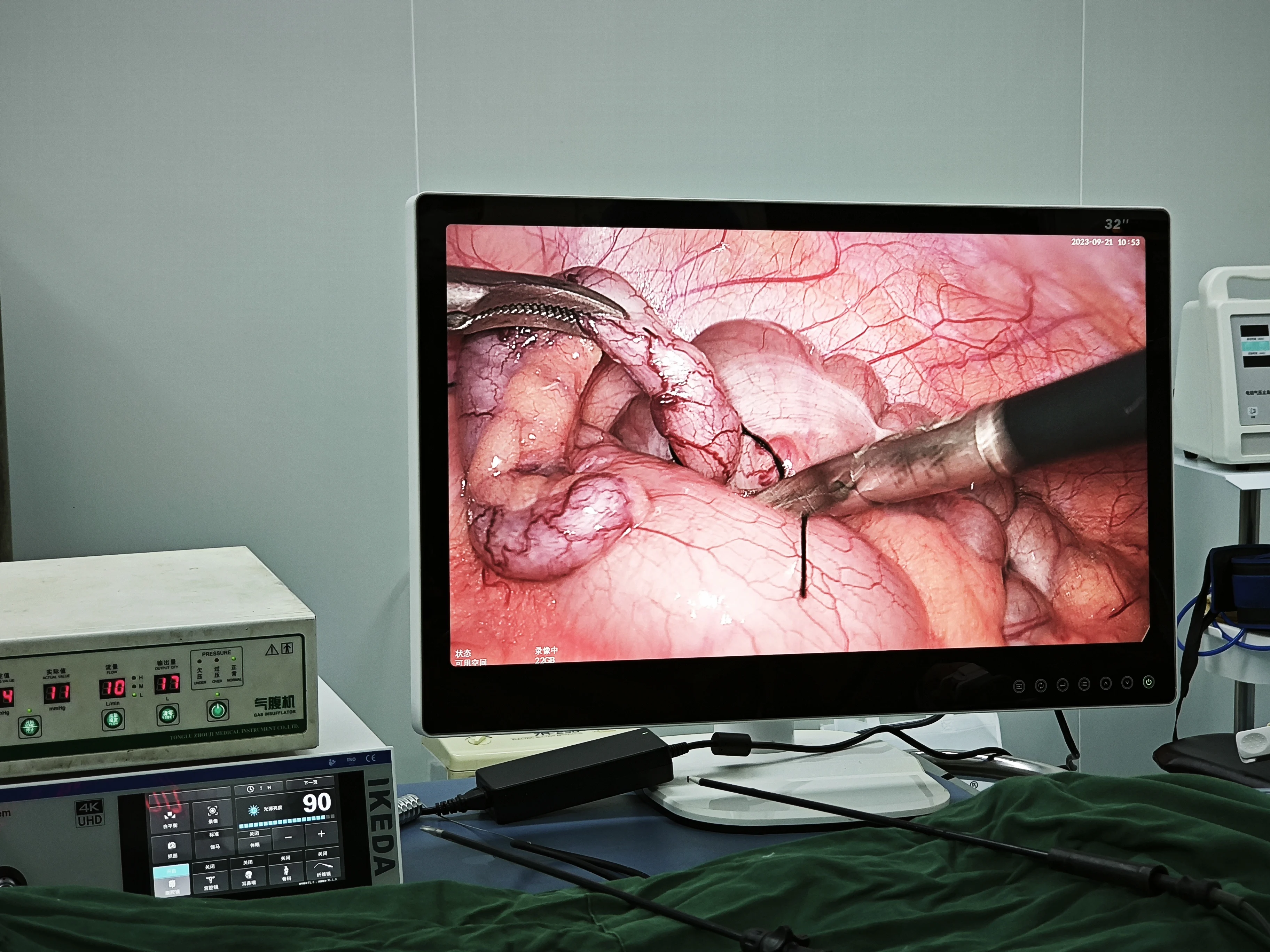 YKD-9210 High Quality 4K Endoscope Camera Medical Endoscope Camera