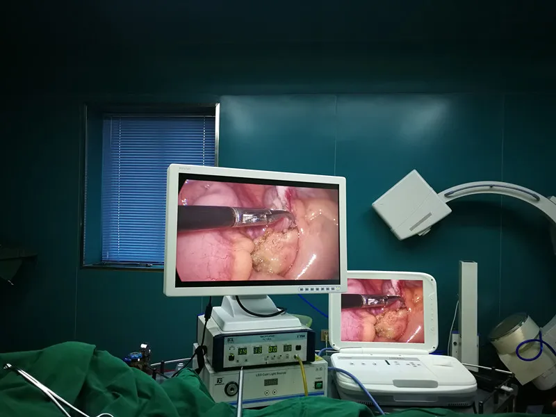 Portable ent surgery endoscope electronic medical endoscope supplier