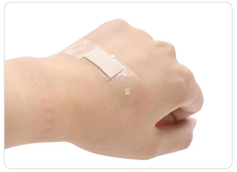 Market wholesale breathable  Healing promoting  medical waterproof bandage