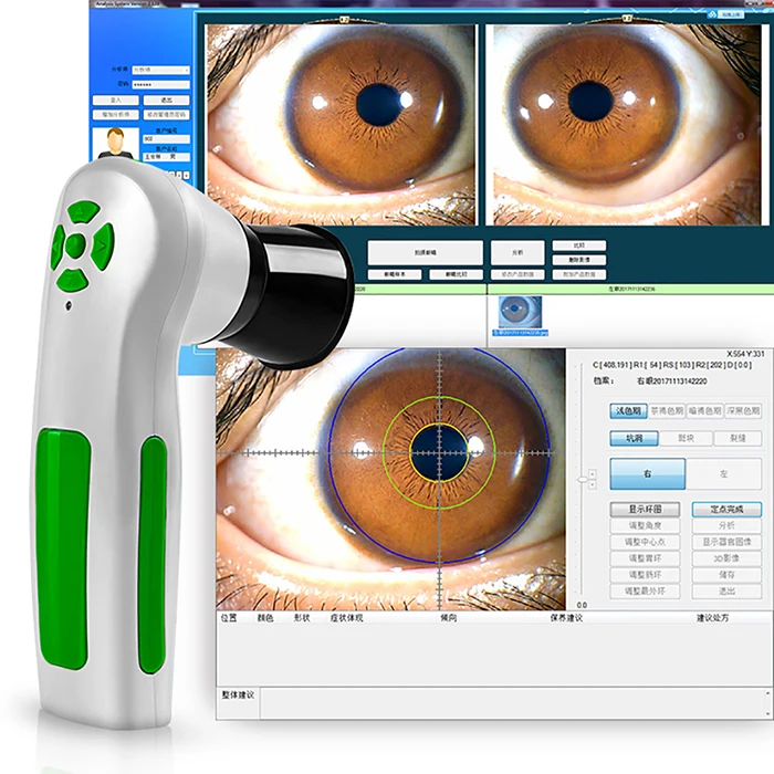SSCH/Suyzeko 2020 new body health diagnosis 12 MP iriscope iridology eye camera analyzer