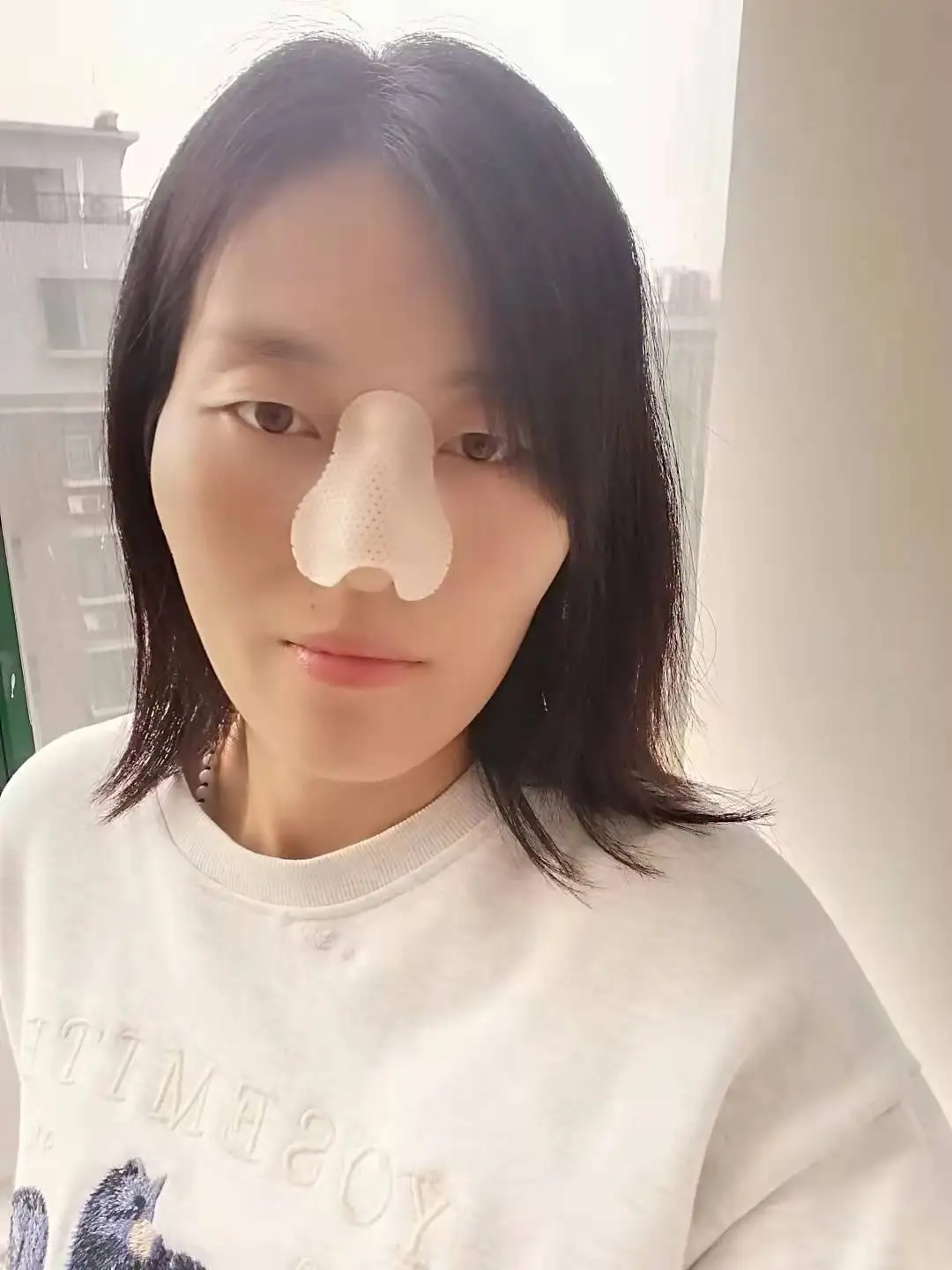 Orthopedic Thermoplastic Nose Cast External Nasal Splint after Plastic Surgery