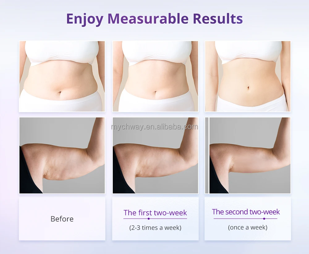 Mychway Radio Frequency Vacuum Fat Loss Salon Beauty Lipo 6 in 1 Cavi Ultraslim Machine