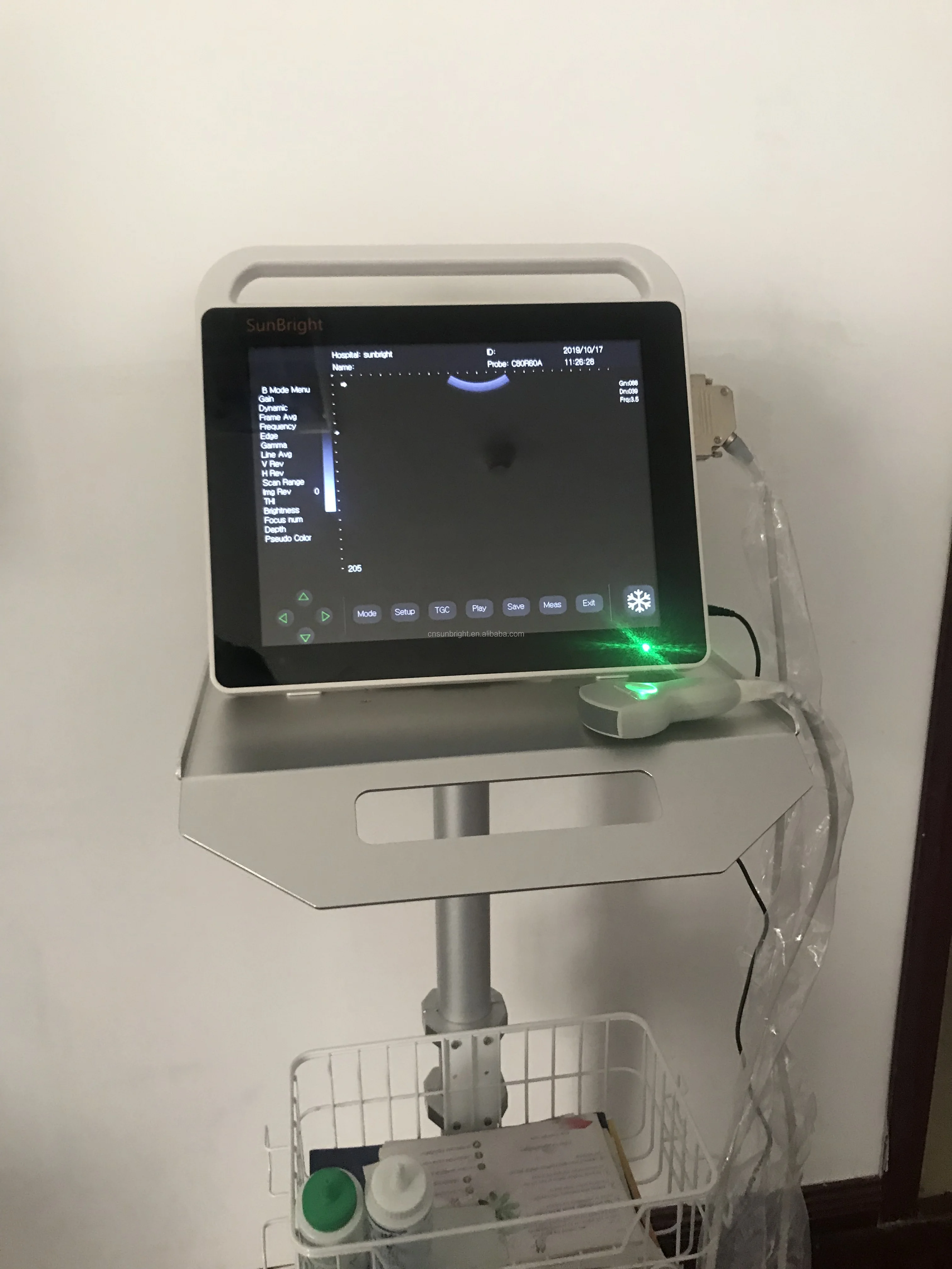  Оптовая цена ультразвуковой аппарат для ноутбука с сенсорным экраном OB/GYN 15 дюймов портативный сканер в