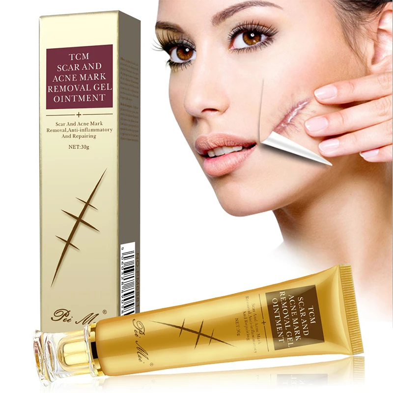Light Print Scars Removal Face Cream Beauty Pure Skin Care Whitening Facial Moisturizing Acne Treatment Face Burn Scar Removal C