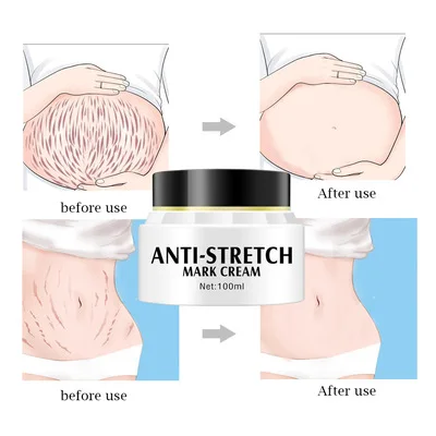 Natural Organic Stretch Mark Remove Cream Skin Repair Anti Vergeture For Pregnancy Scar Marks