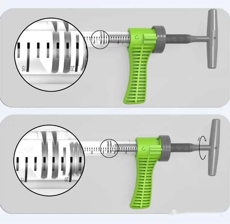 Orthocare Orthopedic Surgery CE EO Sterile PKP Transparent & Light Green Bone Cement Injector