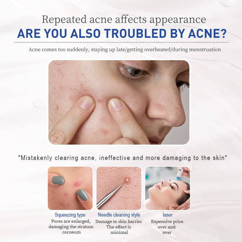 Сыворотка для лечения акне