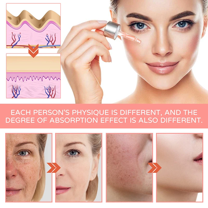 Facial Essence Hyaluronic Acid 5 in 1 Moisturizing Whitening Lightening Spots Anti-Wrinkle Anti-aging Facial Treatment