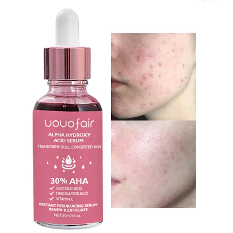 Private Label Anti Acne BHA AHA Face Serum For Body Niacimamide Bha Serum For Face