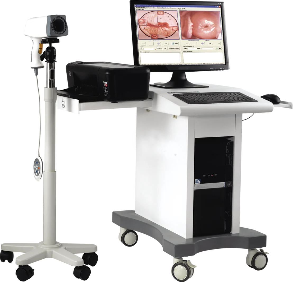 Digital Colposcope Imaging System hot sale hospital POY-2200 hospital medical equipment