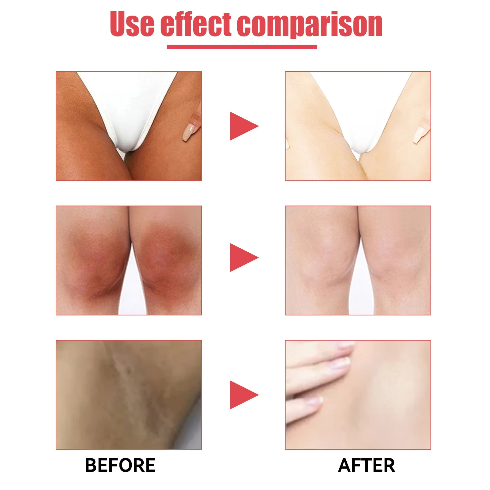 Eelhoe Magic Pink Tender Red Cream Female Private Parts Skin Beauty Vaginal Tightening Gel Repair Melanin Dark Lip Joint