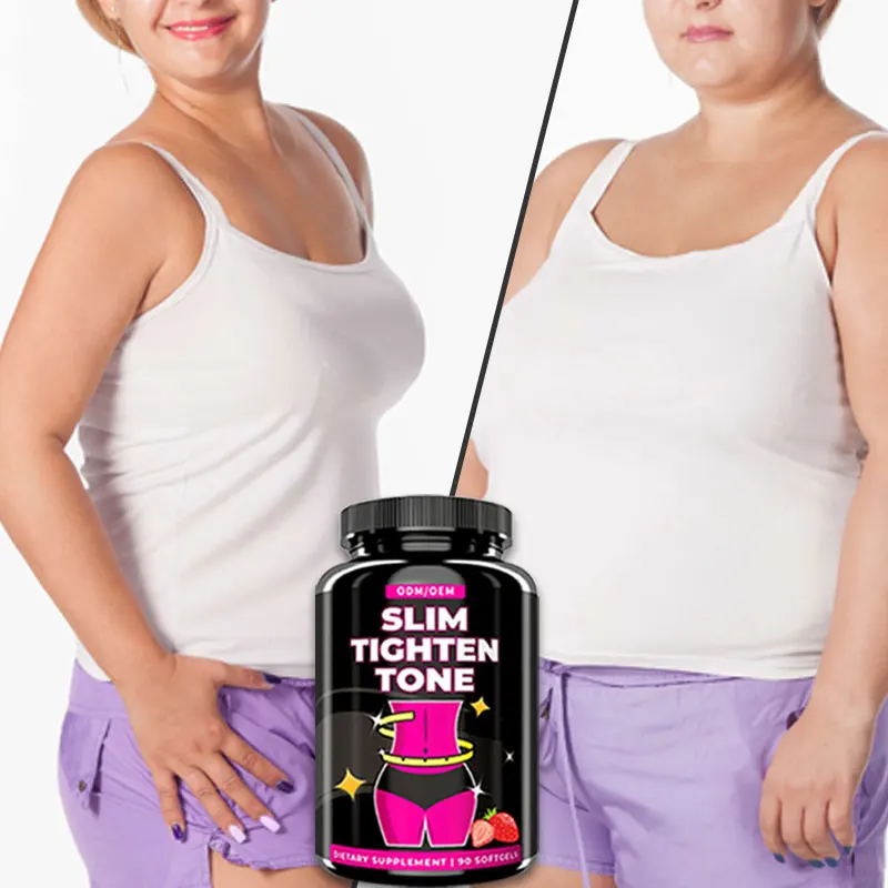 GMP manufactory Diacylglycerol oil green tea coffee weight lose slimming soft capsule fat burner vitamin soft gel capsule