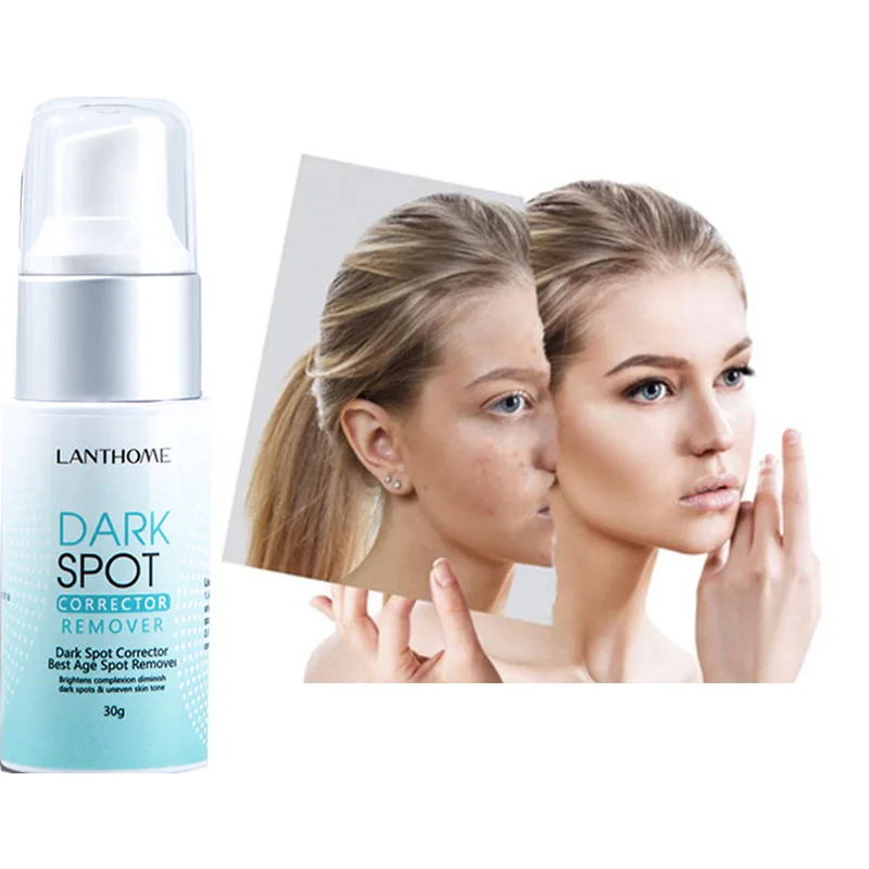 OEM 30g Natural Herbal blemish Serum Freckle Pimples Dark Spot Removal Corrector Eraser Whitening Cream