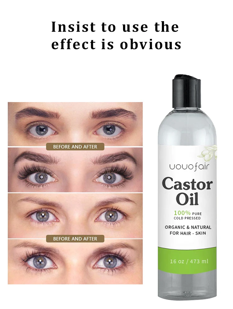 Private Label Amazon Hot Selling Jamaican Black Castor Oil Natural Formula Nourishing Boosting Fast Hair Growth Oil