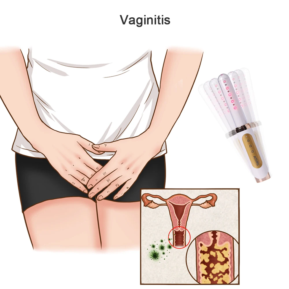 Vaginal care products Vaginal rejuvenation laser gynecological treatment increases collagen and vibrator sticks