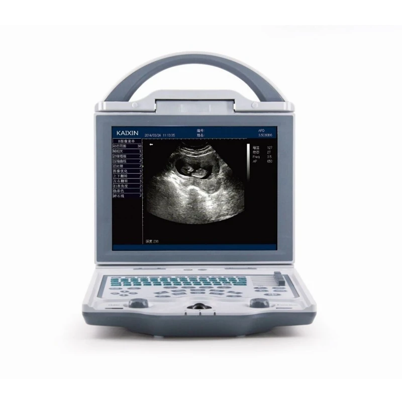 KX5600 Full Digital ultrasound machine portable for Human/Vet