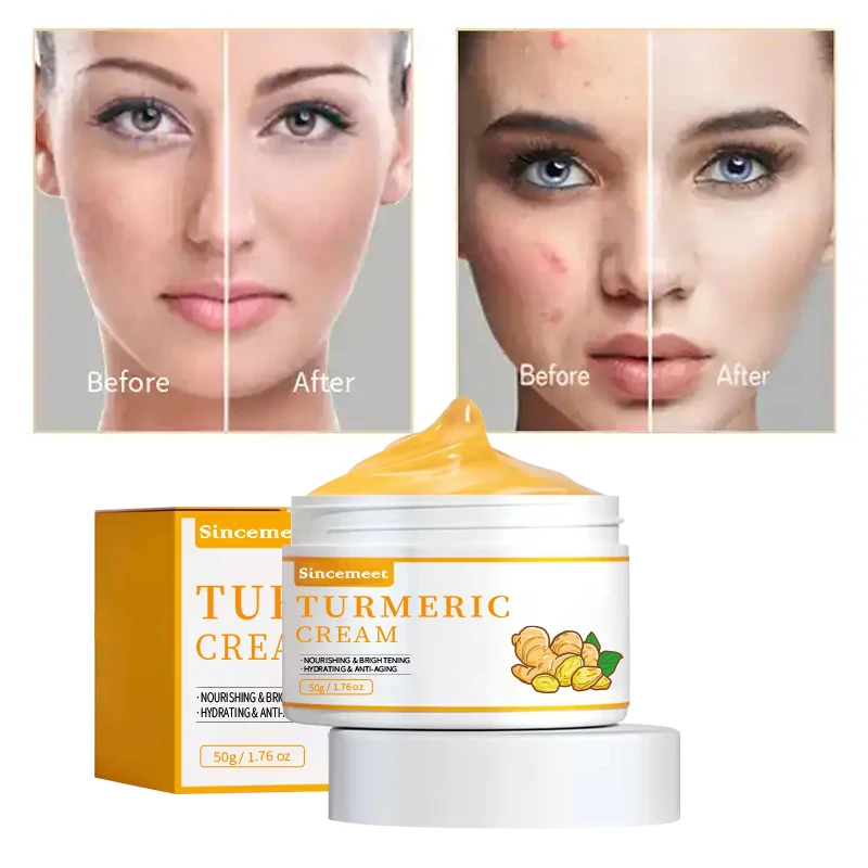 Antiaging Dark Spot Remover Acne Treatment Vitamin C Turmeric Cream Face Moisturising Cream Organics Skin Whitening Cream