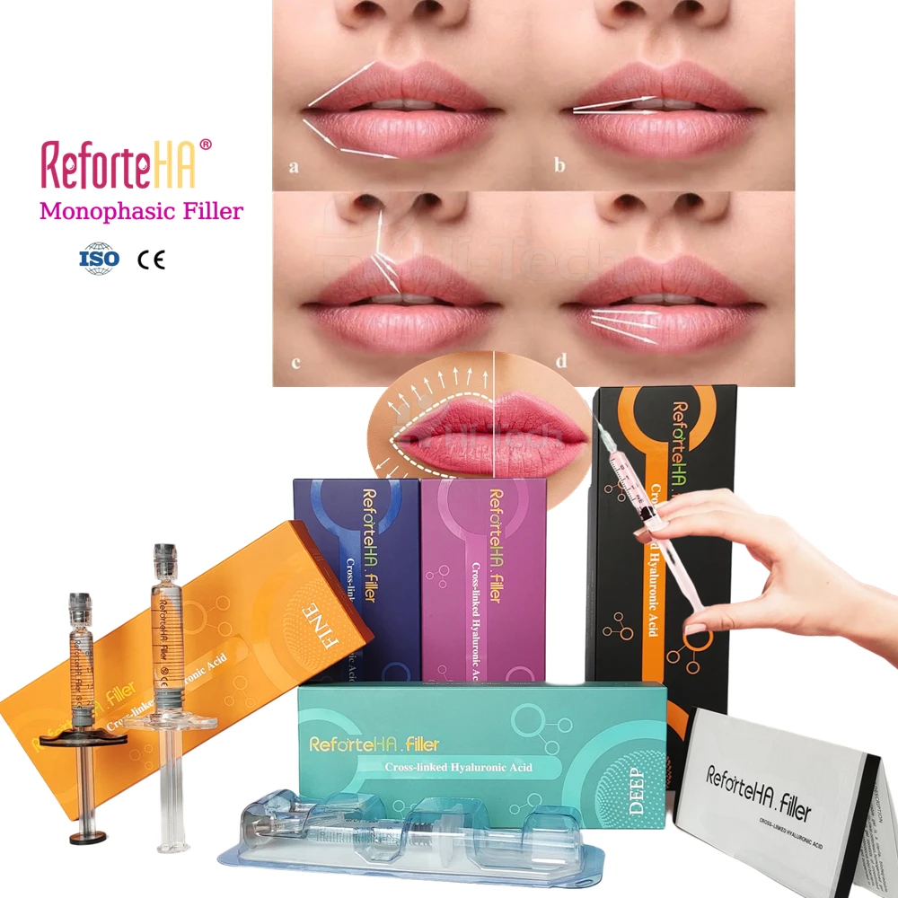 Korean Neuramis 1ml Ha Hyaluronic Acid Filler Dermal Filler Facial Filler For Forehead Nose Lips Chin Face