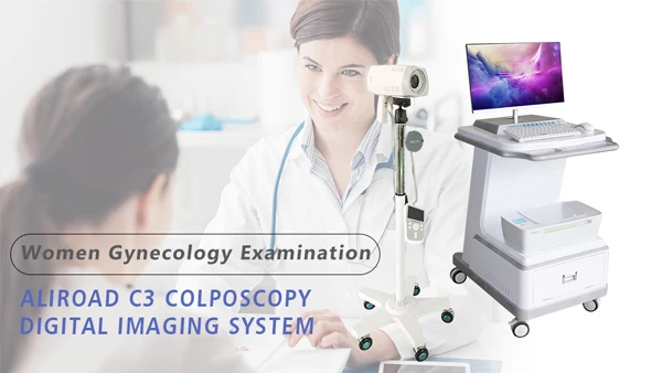 Good quality  C6HD vaginal colposcopy gynecological disease diagnostic instrument that can be customized