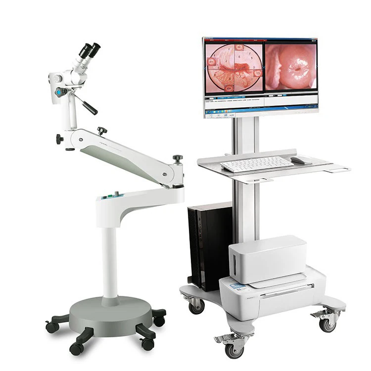 Endoscopy Machine Colposcope Digital Video Colposcope Kernel Colposcope Kn 2200