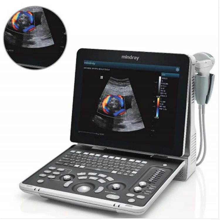 Hot sales Mindray Z50BW color doppler ultrasound diagnosis ultrasound for hospital clinic