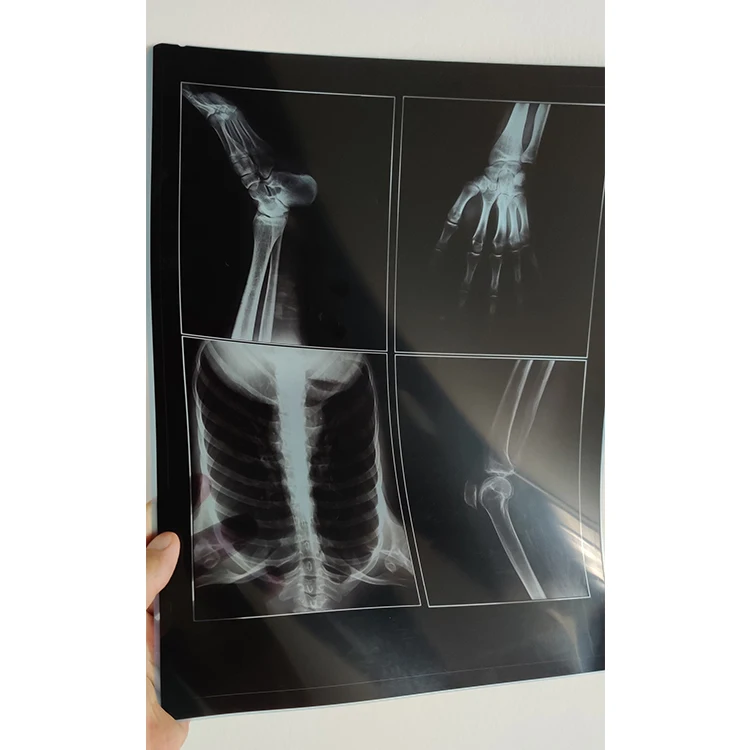 DT2B 10x12 inch medical xray film dry film for  AGFA Drystar  5302/5503 imager