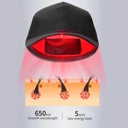 2022 Hot Selling Lasers Helmet Led Hair Loss Protect and Hair Regrowth Laser Helmet for Hair Growth