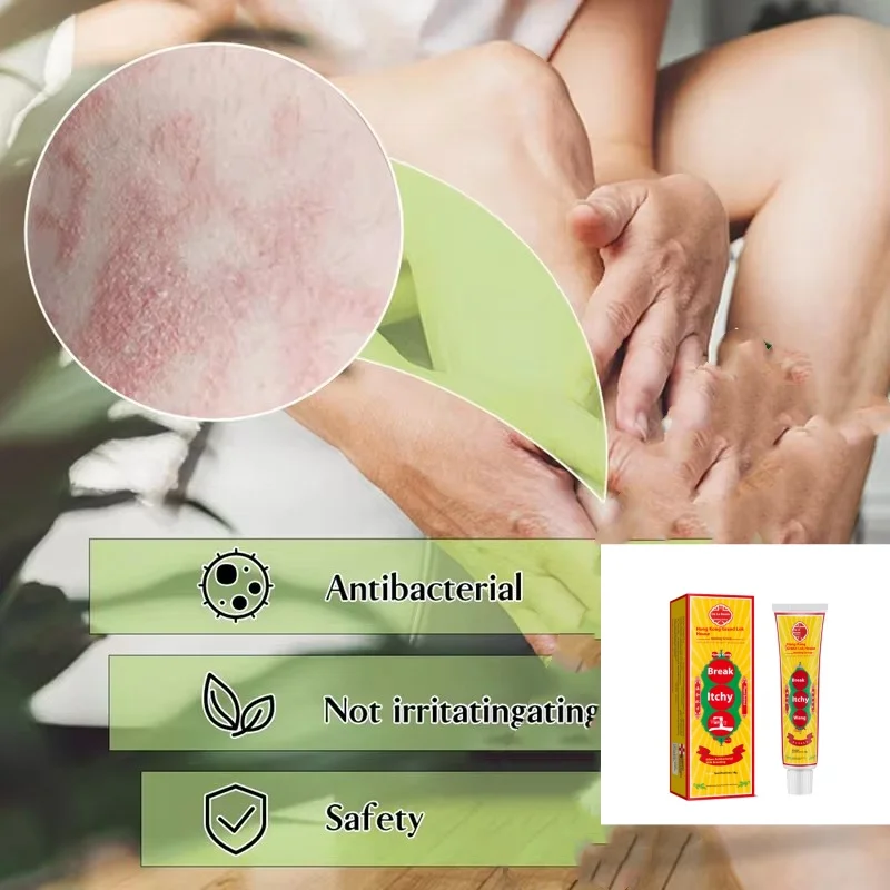 Chinese Herbal Anti Bacterial Cream Effective Anti Fungus Medicine Relieve Itching Skin Treatment Cream 18g