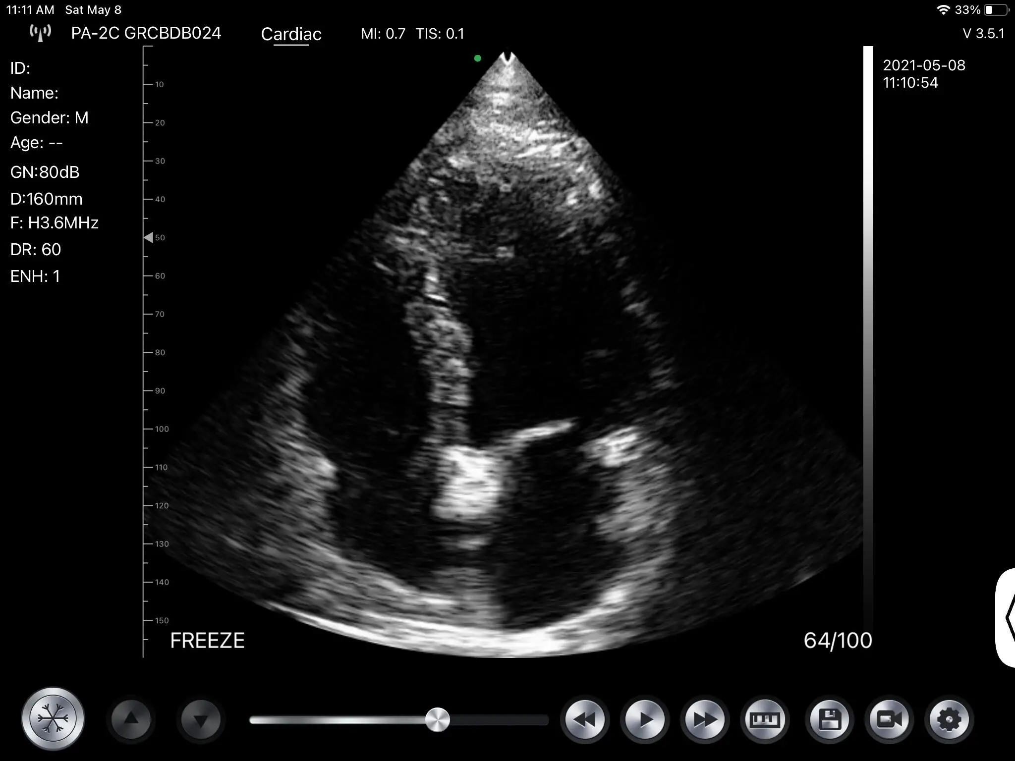 Konted newest portable  examination cardiac wireless ultrasound color doppler probe C10UC