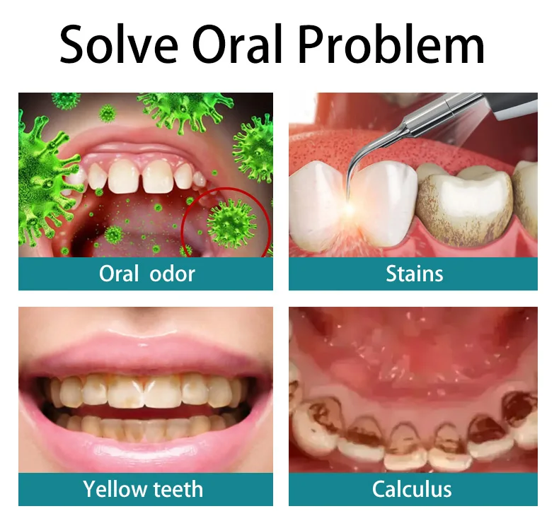 Ингибитор микробов Очистка зубов/отбеливание удаление запаха порошок из бамбукового угля