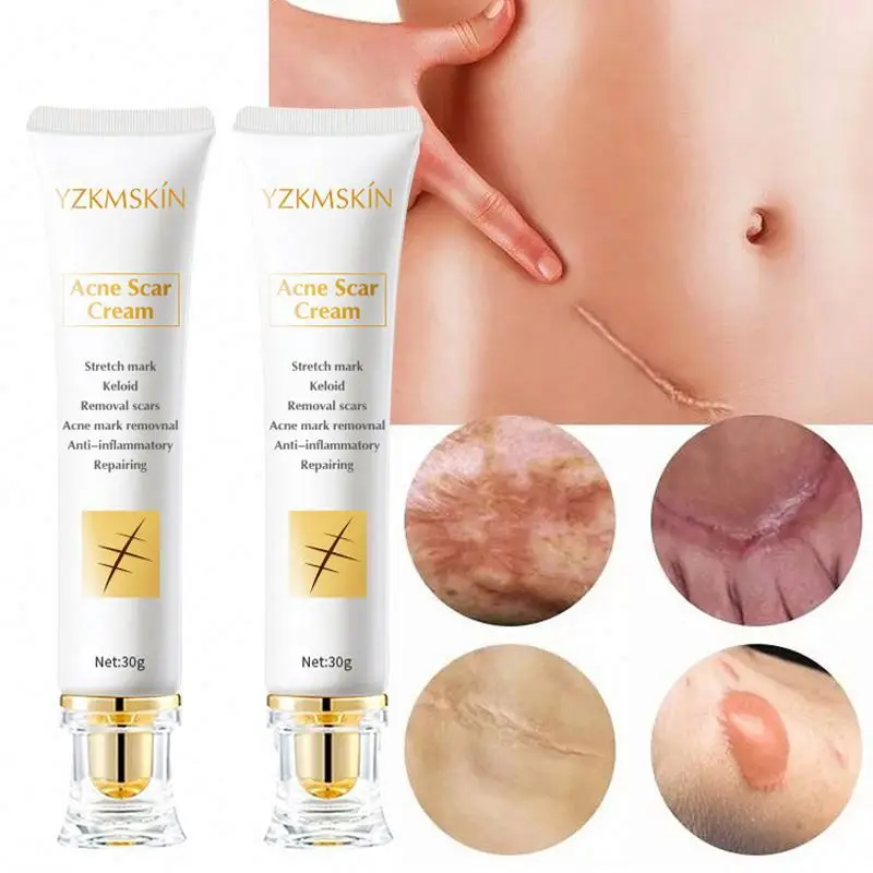 High Quality face Body Skin Repair reduce stretch marks Burn Scar  Repair Acne Scar Removal Cream scar removal cream