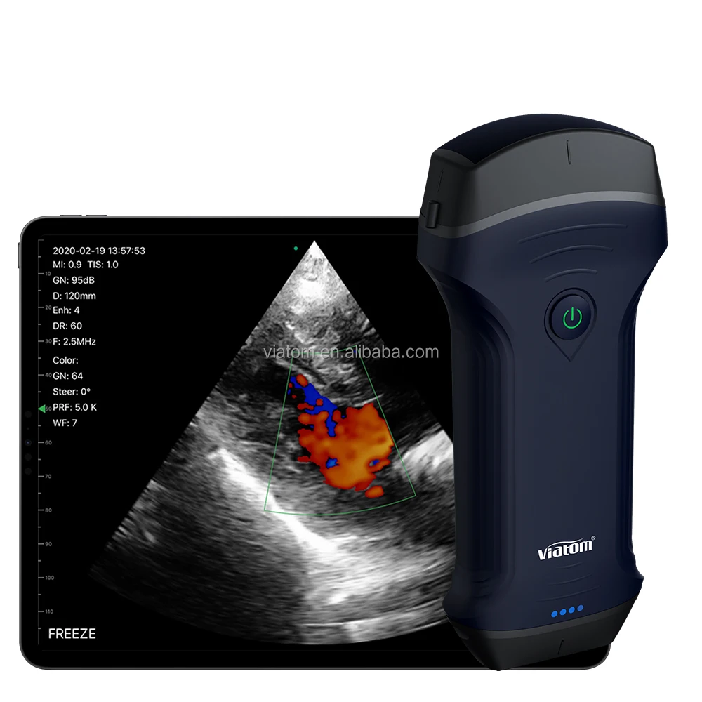 Viatom 2.5/5mhz Portable Ultrasound Machine Portable IP68 Waterproof Design Work Time 3 Hours Medical Handheld Ultrasound Probe