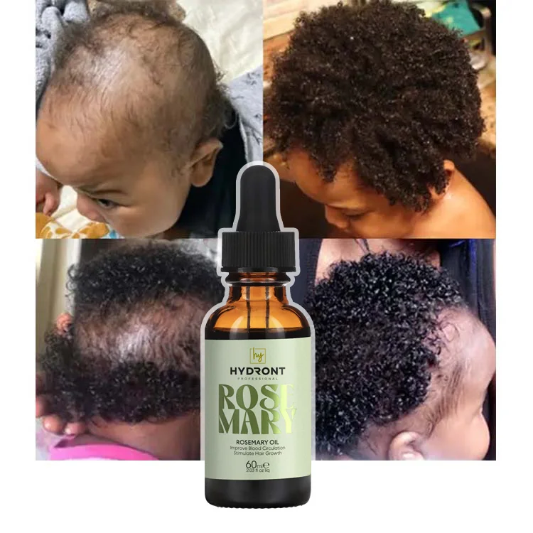 Private Label Pure And Natural Fast Hair Growth Oil Best Sell Rosemary Oil For Kids Hair Growth