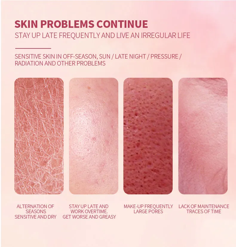 Ready To Ship Korean Cosmetics Skin Care Beauty Whitening Lightening Face Cream For Dark Spot Removal 3