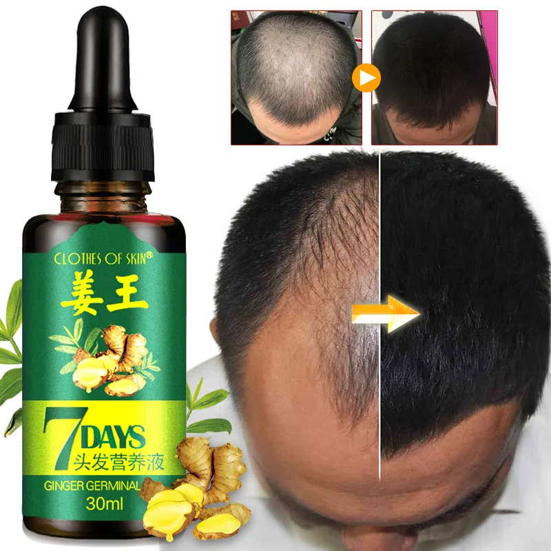 Free Sample 30ML Ginger Hair Oil Mega Growth Healthy Hair Growth Stimulating Oil