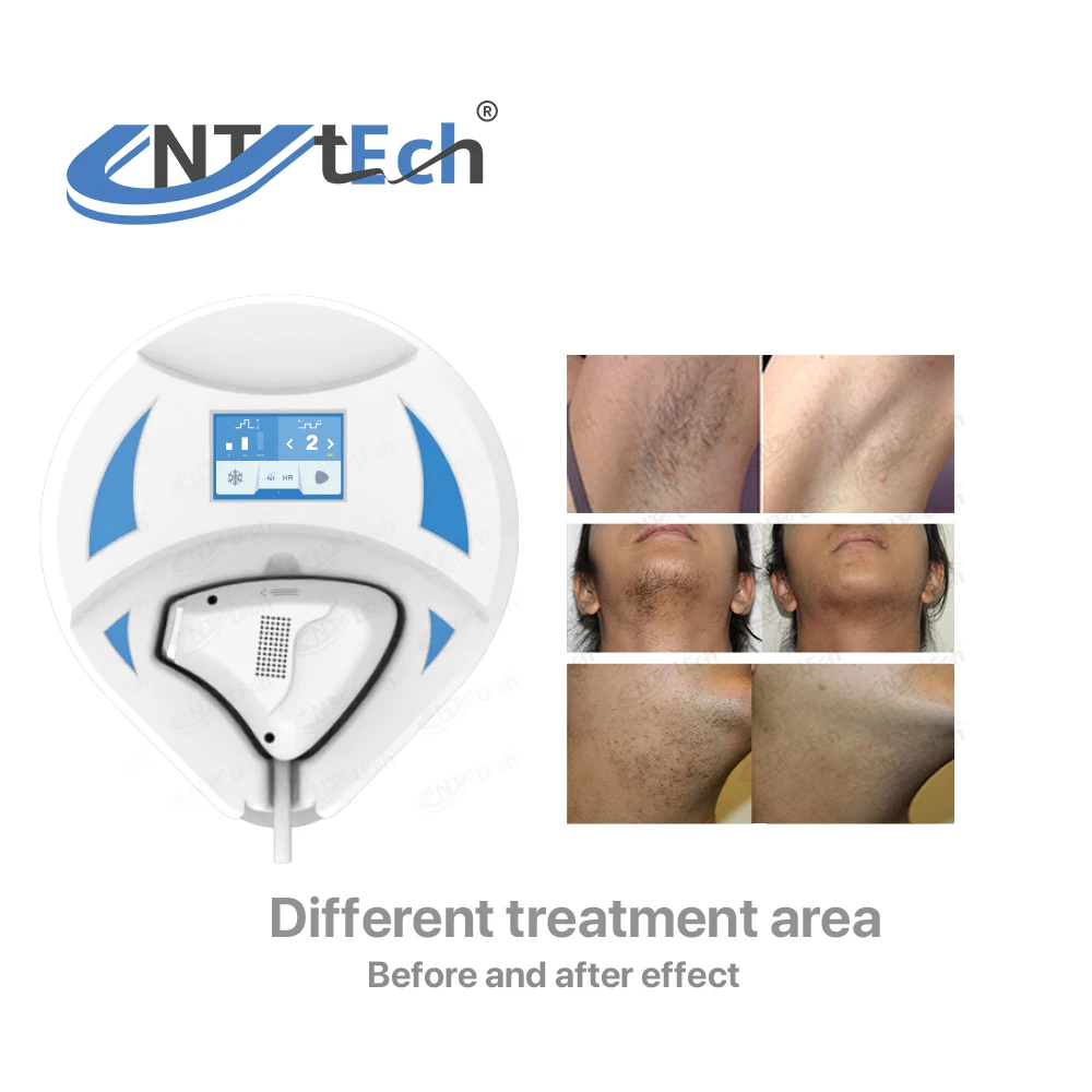 Home use diode laser hair removal device for bikini legs arms face body painless hair remover