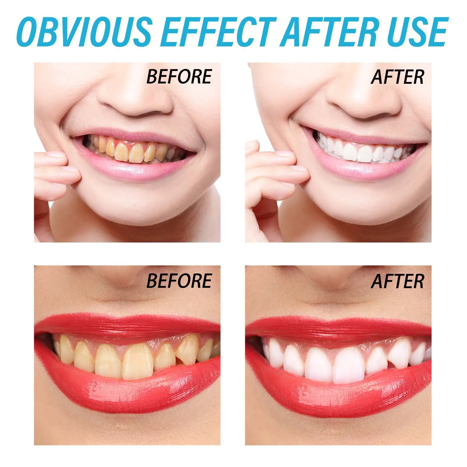 Professional Teeth Whitening Gel Dental Whitening Gel Tooth Whitening Gel