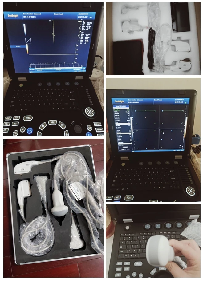 Portable Color Doppler Ultrasound Machine Price Medical Echocardiography with Phased Array Probe