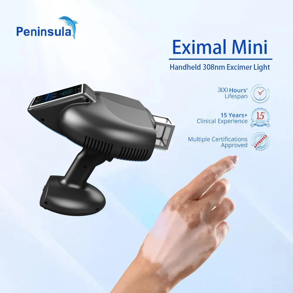 Peninsula Professional Production Uv Phototherapy Light Source Technology Permanent Treatment For Vitiligo