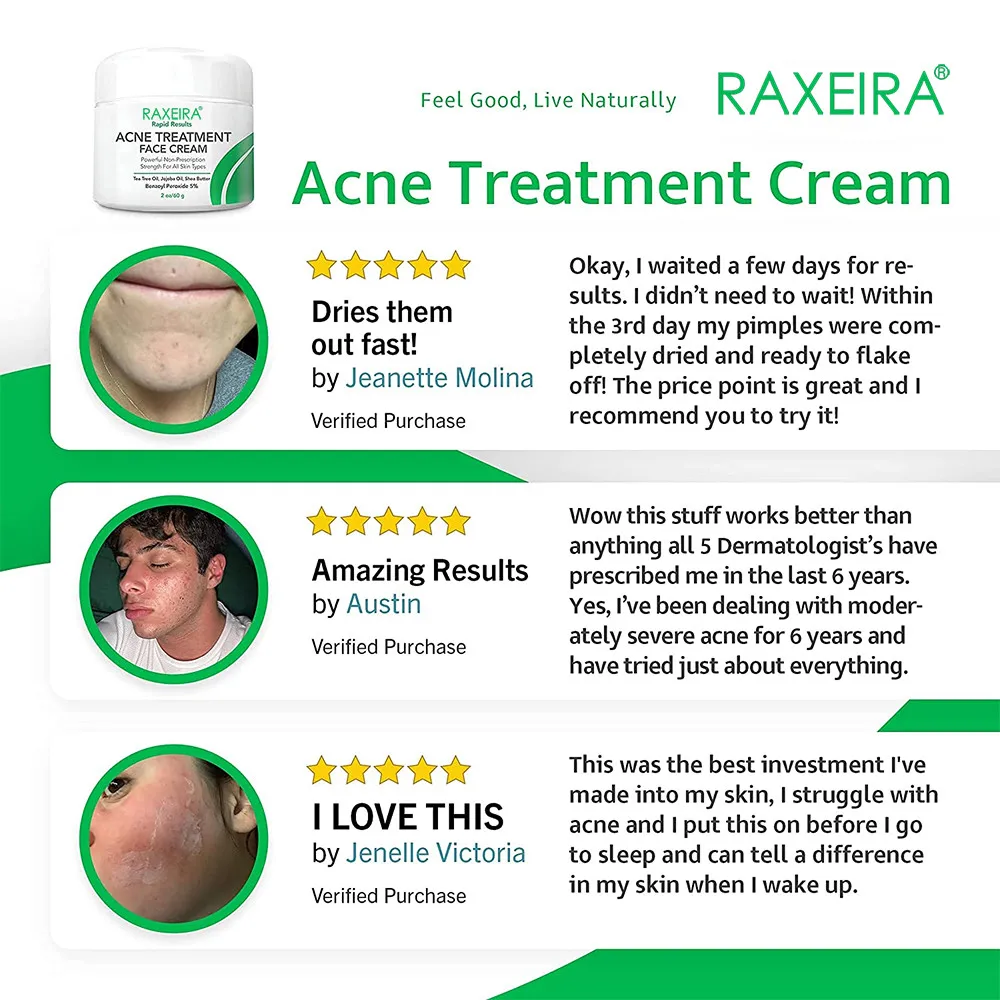 Best Wholesale Herbal Acne Cream Face Care Repair Smooth Skin Shrink Pores Anti Age Acne Treatment Cream For Face Beauty