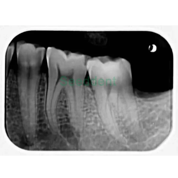 Стоматологический рентгеновский пластинчатый сканер профессиональная Интраоральная визуализация