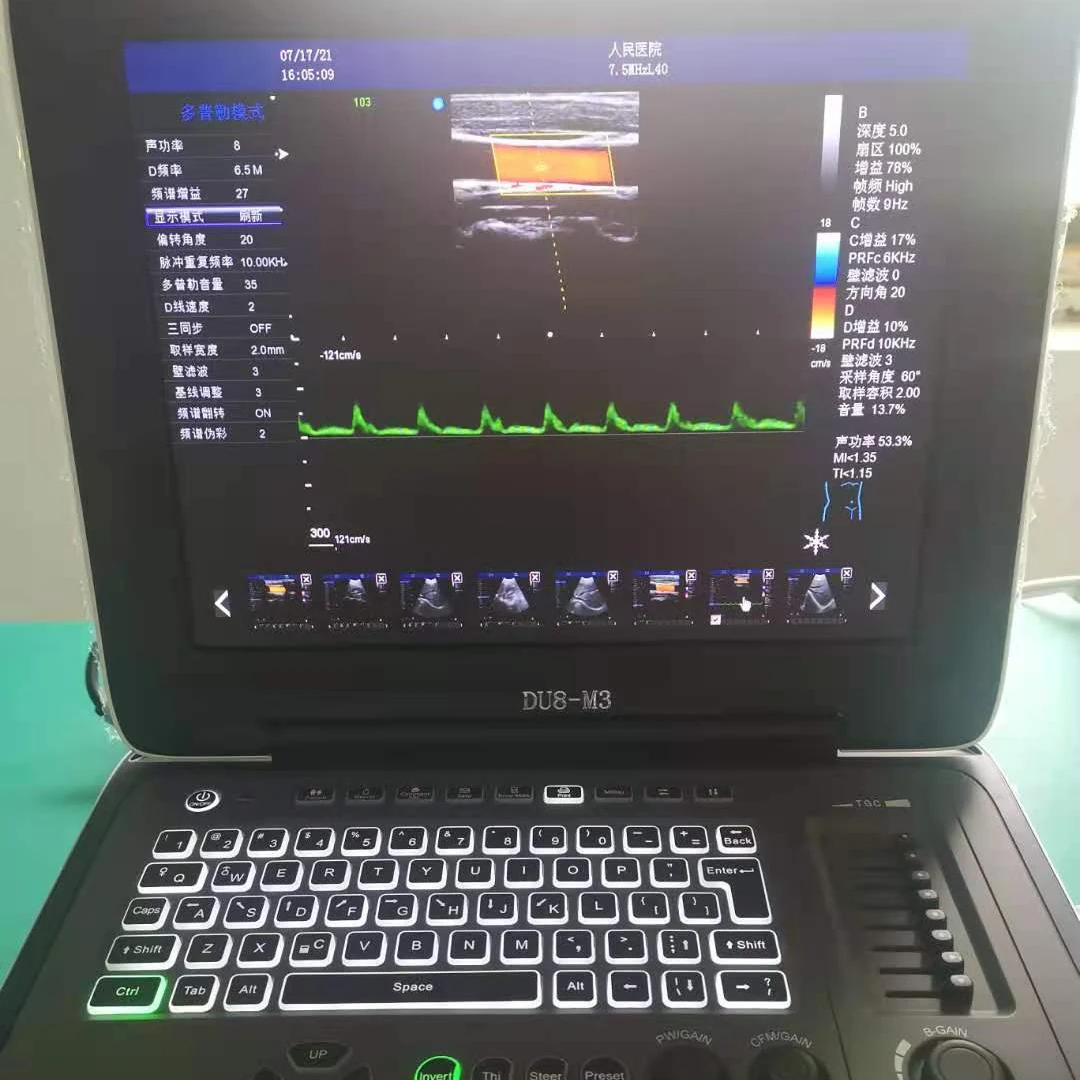 echo machine DU8-M3 factory cheap Price  two probe connectors Color Doppler portable Ultrasound machine laptop cardiac