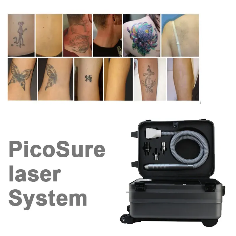 Manufacturer Q Switched Nd Yag Laser Tattoo Removal Beauty Machine Blood Vessels Remova Nd: Yag Laser Erasing Laser Tattoos