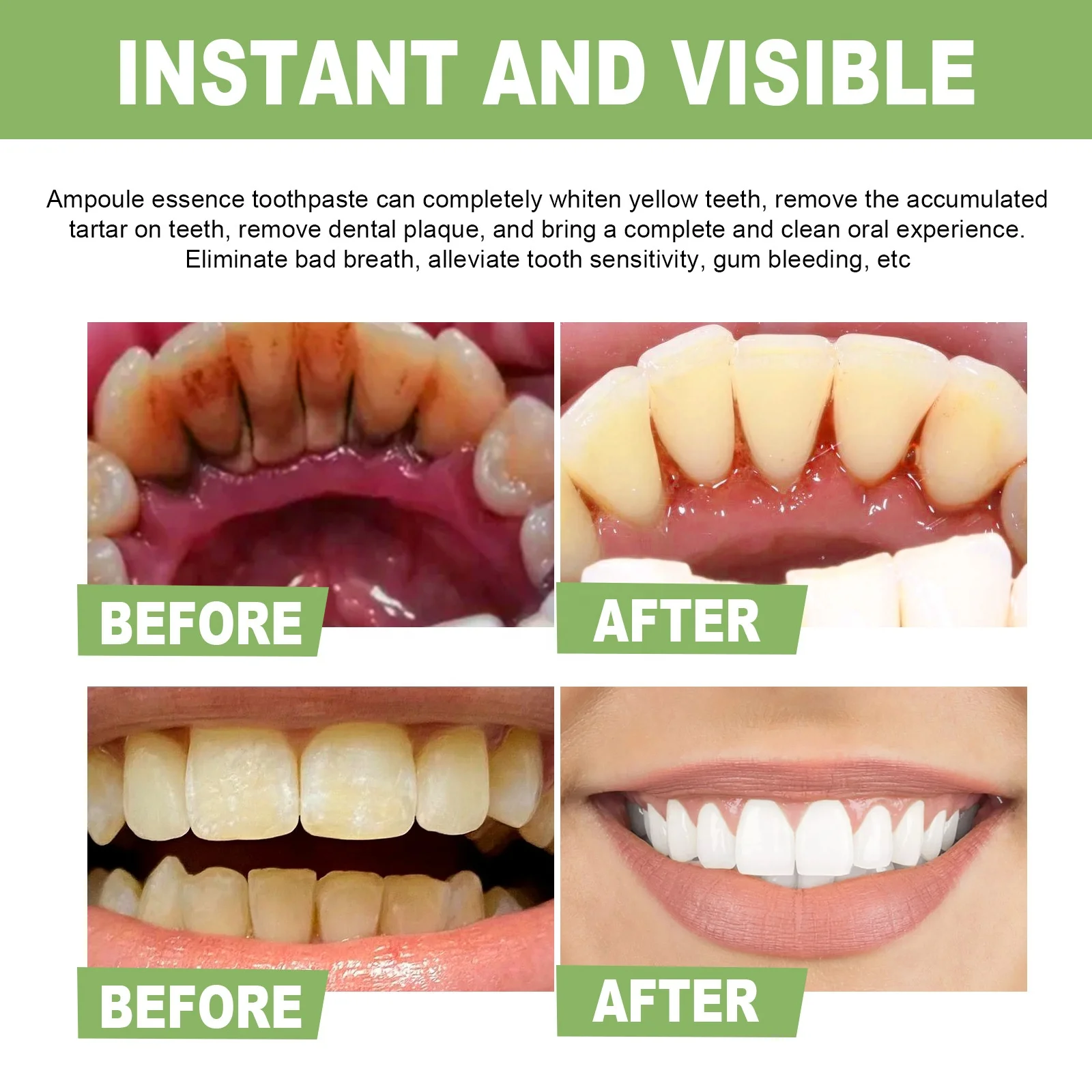 New Hot Selling Oral Product Anti-cavity Anti-bacterial Dental Care Whitening Teeth Color Corrector Tooth Serum