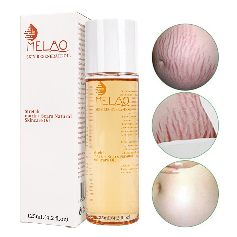 OEM/ODM MELAO Wholesale Stretch Mark Oil Natural Organic Skincare Regenerate Oil Scar Repair Stretch Mark Removal Body Oil